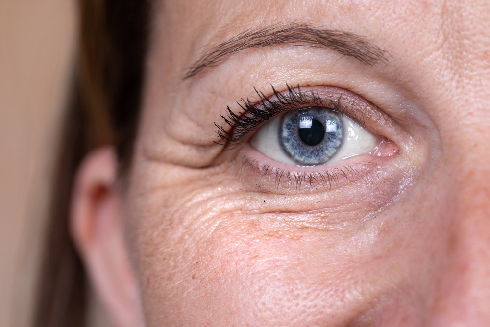 wrinkles eye rejuvenation